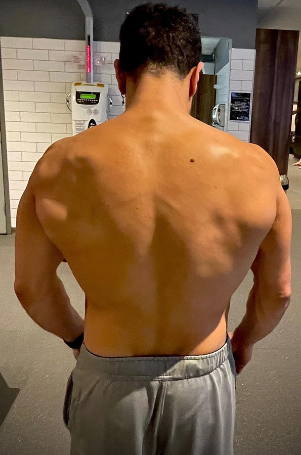 Anoir showing back development